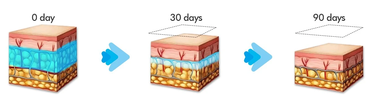 Cryolipolysis Freezing Fat For Weight Loss Machine Cryolipolysis Freezing Fat For Weight Loss Machine